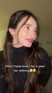 Can only be apart of this tend if you were a brace face 😬 #fyp #braces  #braceface #trend #teethwhitening #teeth #OscarsAtHome