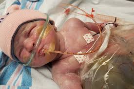 Fundraiser by Carl Ludvigsen : Help Eva Hope and her family.