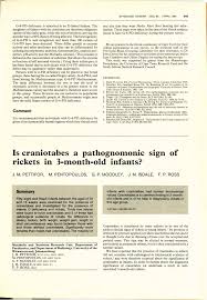 Image result for Craniotabes