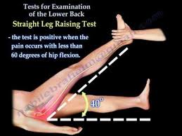 Image result for Low Back Standing Exam