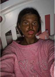 This Woman Left Her Fake Tan On For Too Long And The Results Were Priceless Ladbible