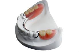 Complete denture or full denture. Removable Partial Dentures Family Dentistry Dental Health Associates
