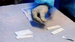 Serological test, serology, blood test, serology test. 34dascl9o52mlm