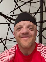 I used to think the Crouzon Syndrome was a curse. Now, I believe it's a  gift. When our perspective changes….. We see how the world works for us not  against us. Stoked