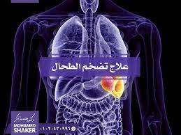 أمراض أخرى movie posters fictional characters poster