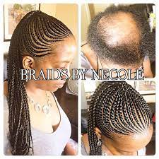 14 Extraordinary Alopecia Camouflage Cornrows By Braids By Necole Braids For Black Hair Braids For Thin Hair Alopecia Hairstyles