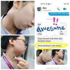 Benjolan Di Leher Hilang Sejak Pakai Pendant Salam Berbagi Jerawat Doa Pengikut