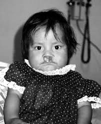 los angeles pediatric society