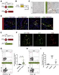 Les épisodes de olive et tom. Differential Contribution Of Pancreatic Fibroblast Subsets To The Pancreatic Cancer Stroma Cellular And Molecular Gastroenterology And Hepatology
