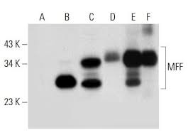 Food preparation, holding, storing, assembling and retail sales direct to a customer. Anti Mff Antibody B 2 Scbt Santa Cruz Biotechnology