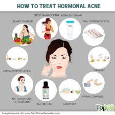 How To Treat Hormonal Acne Top 10 Home Remedies Hormonal Acne Forehead Acne Acne Remedies