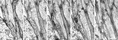 Maybe you would like to learn more about one of these? Gap Junctions On Hippocampal Mossy Fiber Axons Demonstrated By Thin Section Electron Microscopy And Freeze Fracture Replica Immunogold Labeling Pnas