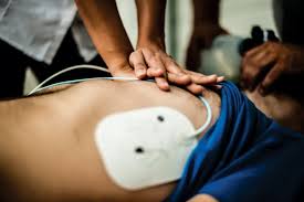 Image result for Chest Pain Observation Unit