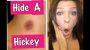 Both men and women can get one from their partners. Love Bite Removal 101 5 Ways To Get Rid Of A Hickey Lifestyle News