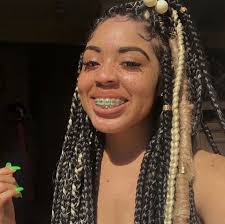 Black And Light Purple Braces Pin By Jb Slayz On Braceface Brace Face Light Skin Girls Hair Styles