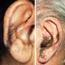 Also, prices are pretty reasonable in most communities. Promotions Laserclinichounslow Com