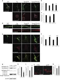 Hd 11:18 une femme noire a pénétré tous les trous sur le canapé 11751 vues. Synaptic Activity Protects Against Ad And Ftd Like Pathology Via Autophagic Lysosomal Degradation Molecular Psychiatry