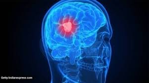 Its main function is to relay information to and from the brain. World Brain Tumour Day 2020 All You Need To Know About Brain Tumours Lifestyle News The Indian Express