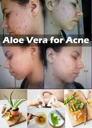 ALOE VERA SMALL GREEN LEAF REDUCE ALL UR ACNE PROB 3 MASK N 1 DRINK