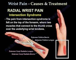 Wrist Pain Causes And Treatment Part 2 Everything You Need To Know Dr Nabil Ebraheim Youtube