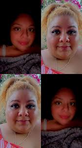 Weight Loss Journey After Bariatric Surgery