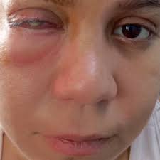 Fundraiser by Lorena Albornoz : A Franchesca Robles para una cirugía ocular