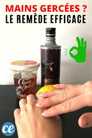 Mains Gercees Le Remede De Grand Mere Que Votre Peau Va Adorer