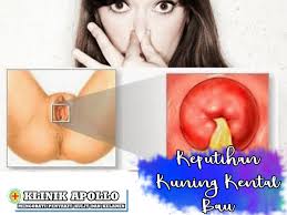 Check spelling or type a new query. Keputihan Kuning Kental Bau Klinik Apollo