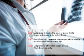 The earlier you can notice symptoms and catch lung cancer, the higher your survival rate, by a long way. Pulmonology Tools Summit Health