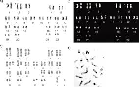 Karyotyping Learn Science At Scitable