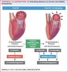 Pin By Andres Sanchez On Cardiology Ecg Interpretation Lv Lv Medical