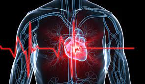 Sca usually causes death if it is not treated within minutes. European Sudden Cardiac Arrest Network Will Look At Gender Based Prevention And Treatment Cardiac Rhythm News