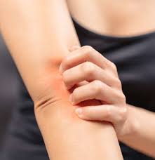 Pelvic pain, including during sex. Menopause Itching Causes Types Home Remedies And Treatments