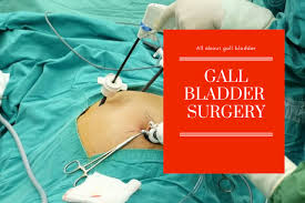 Gallbladder Surgery Gallbladder Surgery Gallbladder Surgery
