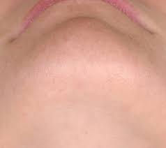 Don't see your favorite business? Laser Hair Removal Plastic Surgery Cleveland Clinic