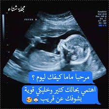 فيديو تاني للحامل يلي بالشهر التاسع وهي عم ترقص. Ø¯ÙƒØªÙˆØ±Ù‡ Ù…Ù† ÙØ¶Ù„Ùƒ Ø·Ù…Ù†ÙŠÙ†ÙŠ ÙˆÙŠØ¨ Ø·Ø¨