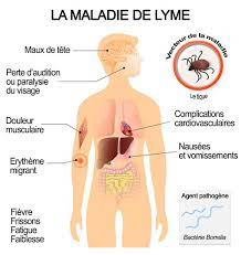 Une éruption d'érythème migrant classique évoque fortement la maladie de lyme, en particulier lorsqu'elle est précédée par d'autres éléments évocateurs (p. Maladie De Lyme Tout Ce Qu Il Faut Savoir Blog Sante Espace Patients Laboratoires Ketterthill