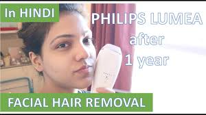 laser treatment for hair removal on