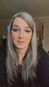 Dog Gets Attacked at Dog Park Old Lady