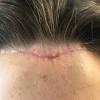 How can i lower my forehead? Https Encrypted Tbn0 Gstatic Com Images Q Tbn And9gctubpkkfo3idqxnnij9buiuaawcbmvcyb Mfdhn2zjgwgialimy Usqp Cau
