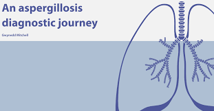 There are several different types of aspergillosis. An Aspergillosis Diagnostic Journey Aspergillosis Patients And Carers