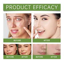 EELHOE Aloe Vera Facial Toner Hydrating Soothing Skin Lotion Nourishing  Moisturizer for Face Alcohol-Free & Gentle Skin Care