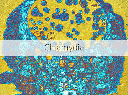 How long does a chlamydia test take. How Long Does It Take To Test Positive For Chlamydia Std Tests