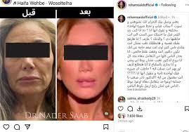 قبل ريهام سعيد.. فنانات سقطن في «فخ عمليات التجميل» (صور)