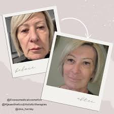 We invite you to visit our state-of-the-art DNA Health Club in  Henley-on-Thames. 🧬🏢😊 Our multidisciplinary team of physicians,  clinicians, and aestheticians provides bespoke services. 👨‍⚕️👩‍⚕️🤝 We  employ only the safest, gold-standard techniques