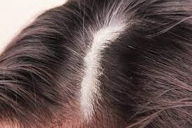 Does Your Scalp Itch And Do You Notice A Yellowish Substance That Gets Lodged In Your Fingernails After S Thick Hair Remedies Hair Buildup Thick Hair Solutions