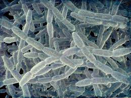 After legionella grows and multiplies in a building water system, water containing legionella can spread in droplets small enough for people to breathe in. Why Reports Of Legionnaires Disease Are On The Rise In The United States Science Smithsonian Magazine