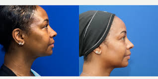 Northwestern Specialists in Plastic Surgery, S.C.