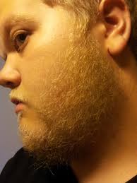 3 month update, trimming tips?