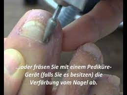 fussnagel nagelveranderungen fussnagel spray von jenn cosmetic zehennagel fussnagel nagelpilz hausmittel